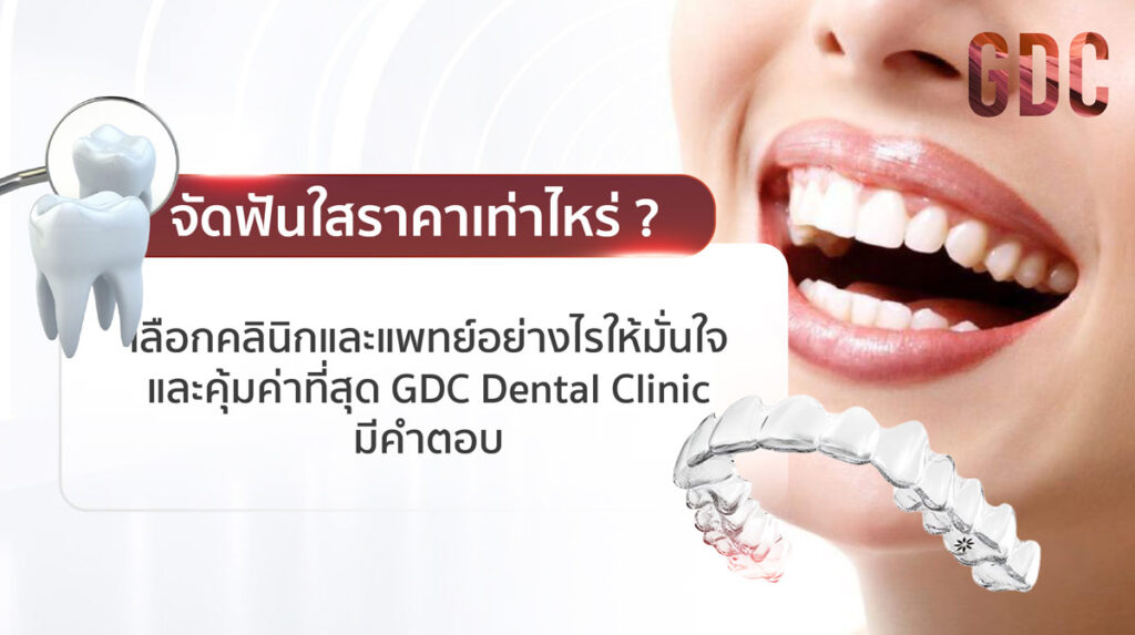 จัดฟันใสราคาเท่าไหร่